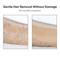 Încărcați imaginea în vizualizatorul Galeriei, 1+1 Cadou - SoftSkin, un dispozitiv de îndepărtare a părului cu cristale care reduce părul și încetinește creșterea părului
